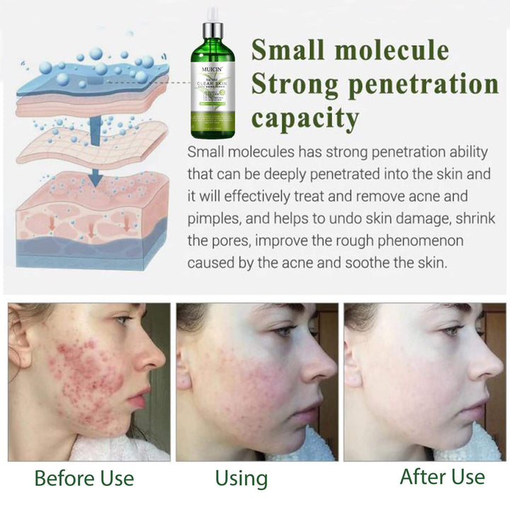MUICIN - Tea Tree Anti Aging Clear Skin Face Serum - 100ml Best Price in Pakistan