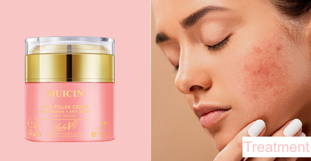 MUICIN - Baby V9 Jar Lazy Girl’s Skin Polish Cream - 50g Best Price in Pakistan