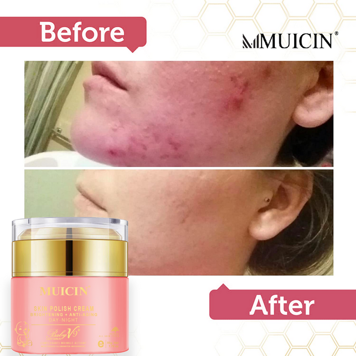 MUICIN - Baby V9 Jar Lazy Girl’s Skin Polish Cream - 50g Best Price in Pakistan